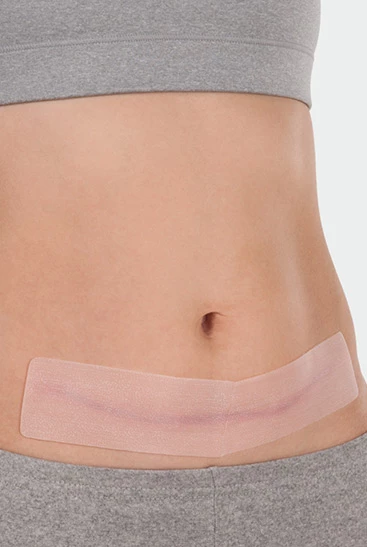 Silicone Scar Pad